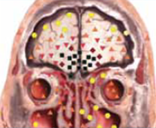 Example photo of part of body 1 by Metatron 4D