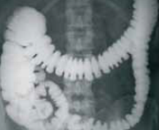 Example photo of part of body 2 by Tomography