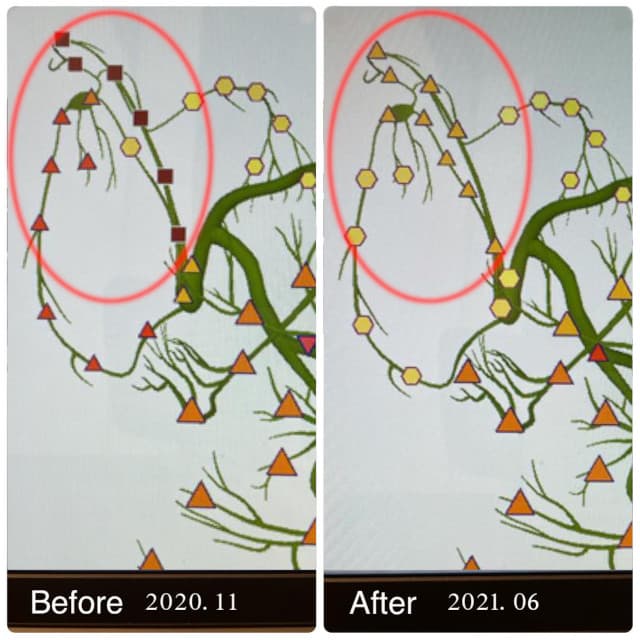 メタトロン ホリスティック 〜未来の人間ドック!先端テクノロジー装置「メタトロン」による健康管理〜の採用する4Dメタトロンによるメタセラピー事例② 心脈